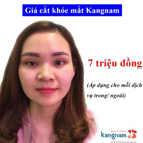 mở rộng góc mắt