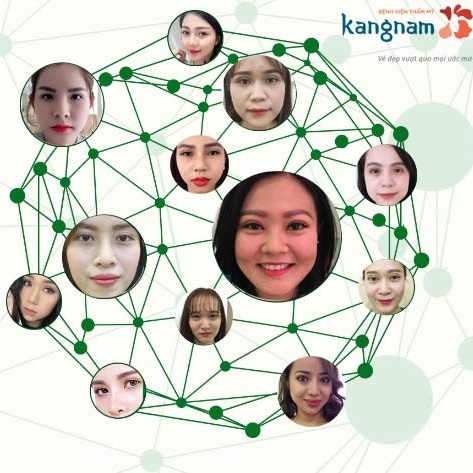 Hình ảnh trước và sau thẩm mỹ mắt tại Bệnh viện thẩm mỹ Kangnam