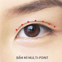 Bấm mí mắt Multi Point – Ưu điểm vượt trội với nhấn mí mắt thông thường.