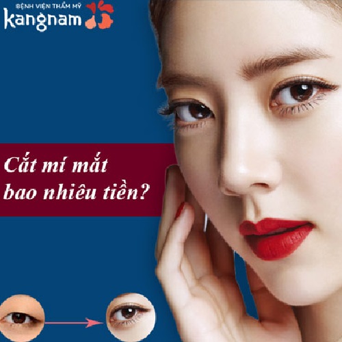 Cắt mí mắt giá bao nhiêu tiền – Bảng giá ưu đãi cắt mí mắt Kangnam 2020