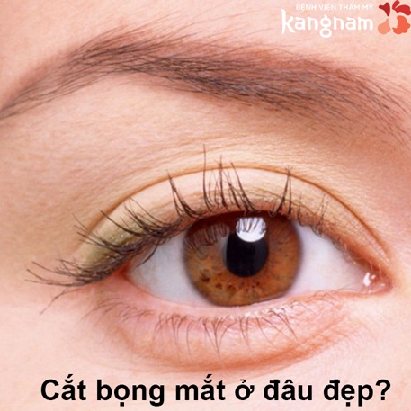 Địa chỉ cắt bọng mắt dưới ở đâu đẹp và an toàn? 3 Nguyên tắc cần lưu ý