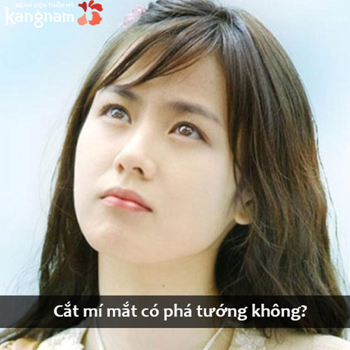 Cắt mí mắt có phá tướng không? 2 Luồng ý kiến “trái dấu nhau”