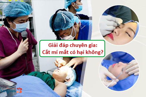 cắt mí mắt có hại không