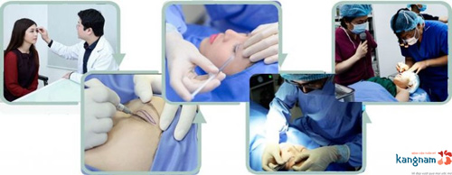 Phẫu thuật cắt mắt 2 mí có hại không 