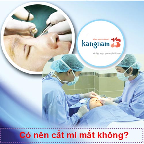 Cắt mí mắt nên hay không? Liệu có nên cắt mí mắt không? Sao việt chia sẻ kinh nghiệm