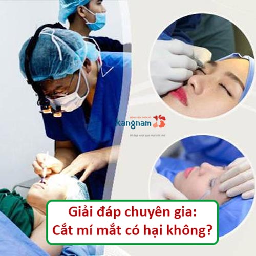 Cắt mí mắt có hại không? Sau cắt mí mắt có để lại di chứng gì không?