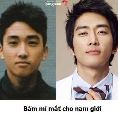 Bấm mí cho nam giới → Sở hữu vẻ ngoài chuẩn nam thần Hàn Quốc!!
