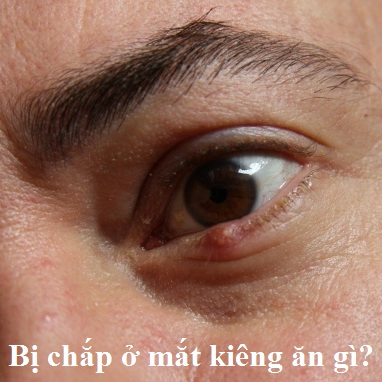 Bị chắp ở mắt kiêng ăn gì, nên ăn gì để mắt nhanh lành và tránh bị sẹo?