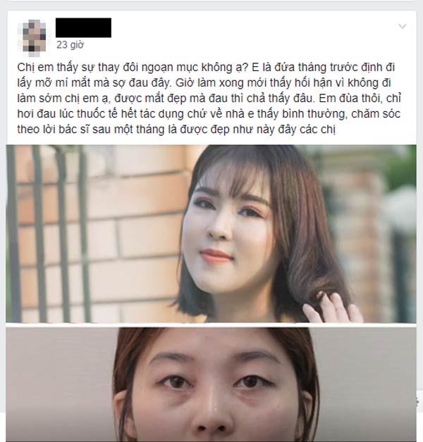 lấy bọng mắt có đau không 