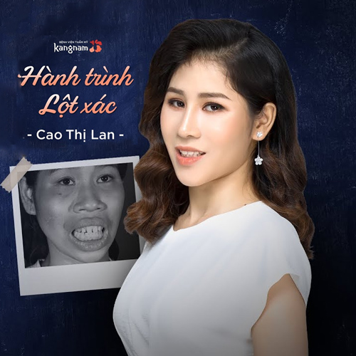 Cao Thị Lan Hành Trình Lột Xác 2018 – Sự thay đổi số phận đầy nước mắt