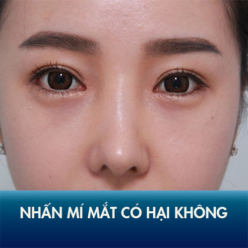 Nhấn mí mắt có hại không? 4 Sự thật về bấm mí mắt bạn phải nhớ rõ